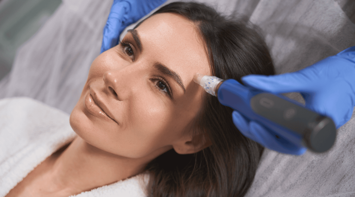 Microneedling-Behandlung für glatte, strahlende Haut